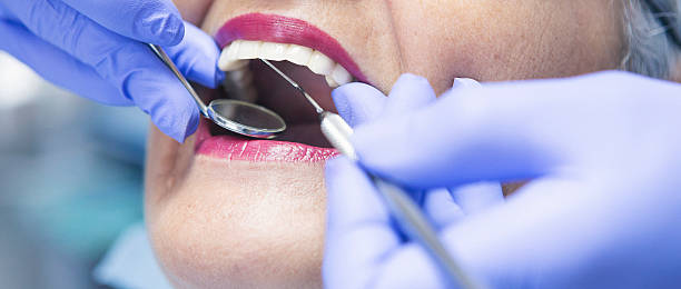 Best Emergency Denture Repair in Council Bluffs, IA
